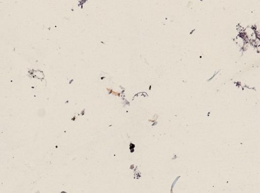 Onchocerca volvulus