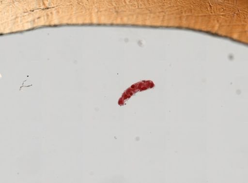 Trematoda