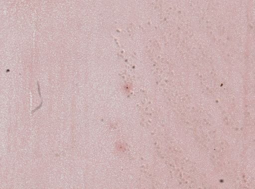 Plasmodium vivax