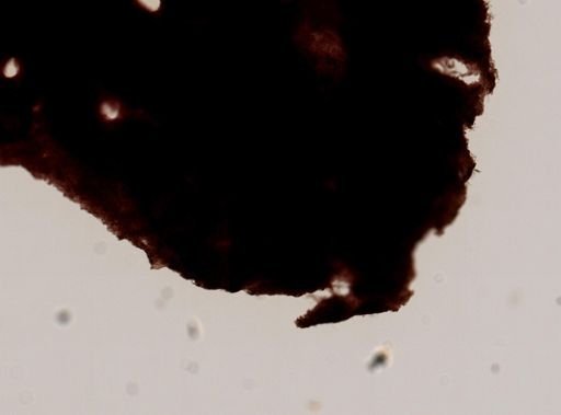 Keratosa