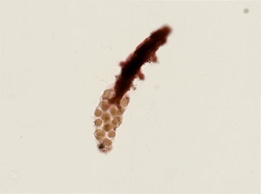Dactylobiotus