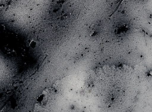 Entamoeba coli