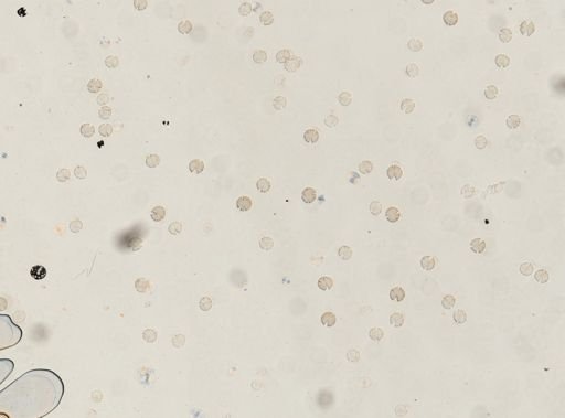 Taenia saginata