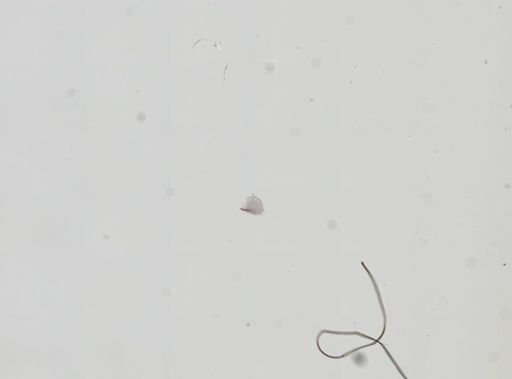 Hyalella cf. azteca