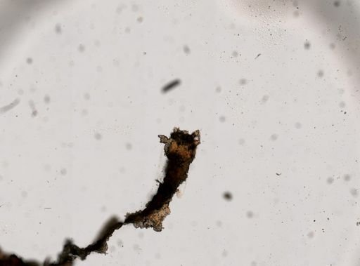Ascaris lumbricoides