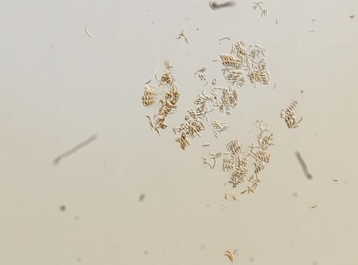 Somatogyrus subglobosus