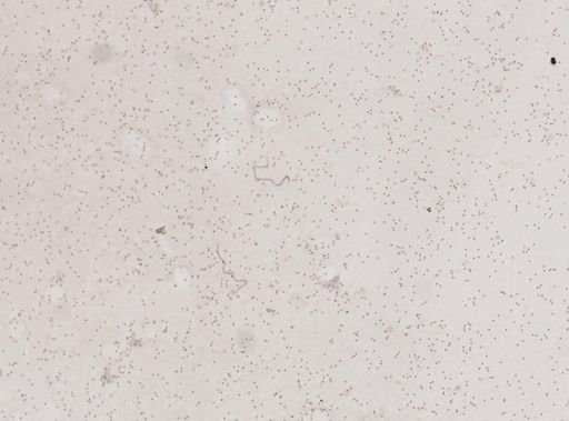 Wuchereria bancrofti