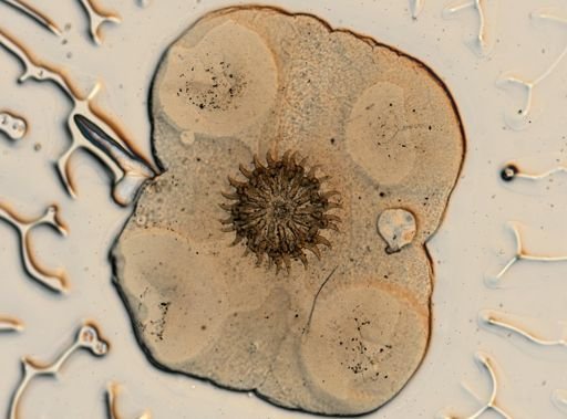 Taenia solium
