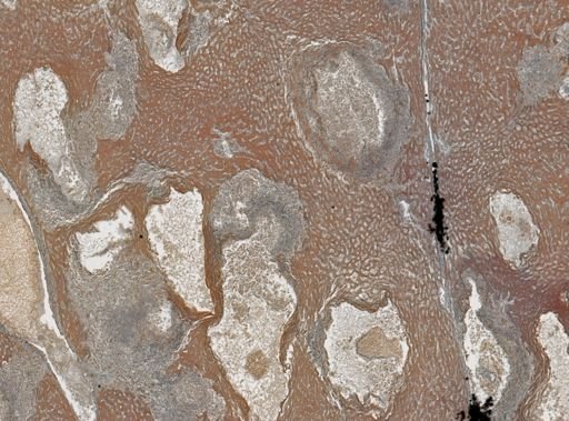 Taenia crassicollis
