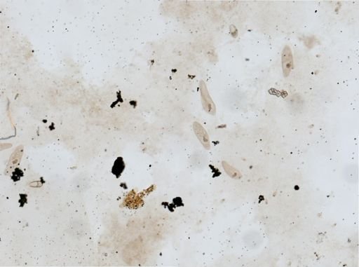 Paramecium aurelia
