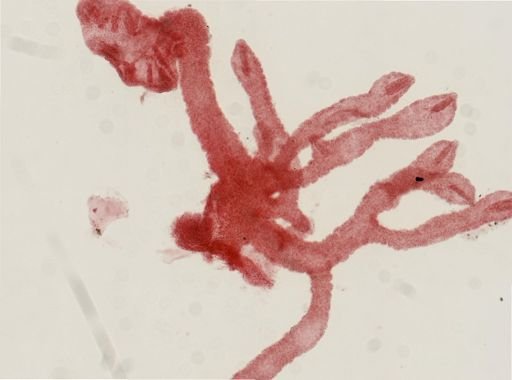 Enoplobranchus sanguineus