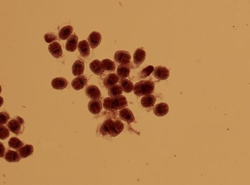 Echinococcus granulosus
