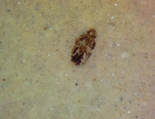 undet. Coleoptera
