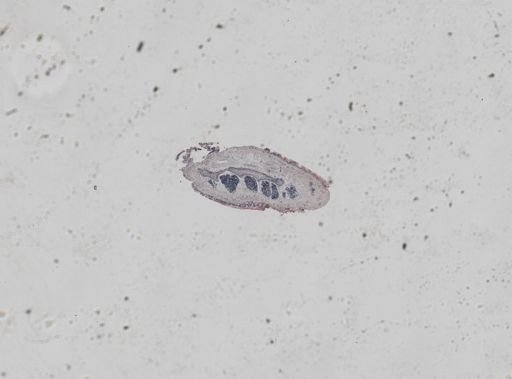 Lineus sanguineus