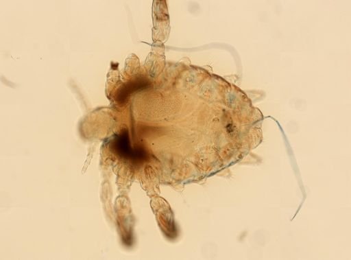Pthirus pubis