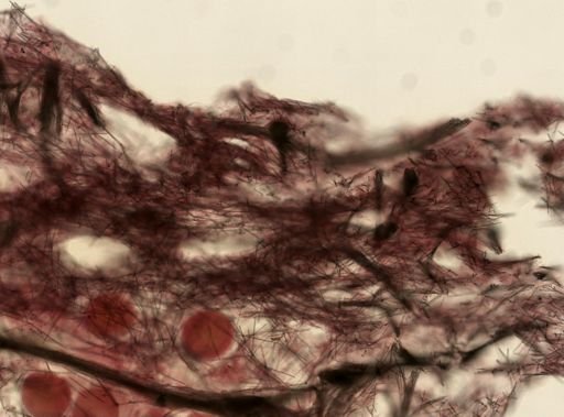 Mycale (Zygomycale) parishii