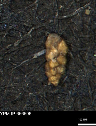 Verneuilina canadensis