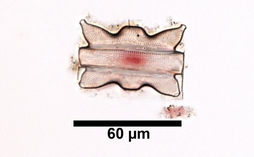 Odontella aurita