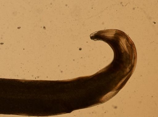 Enterobius vermicularis