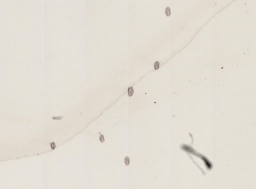 Bursaria truncatella