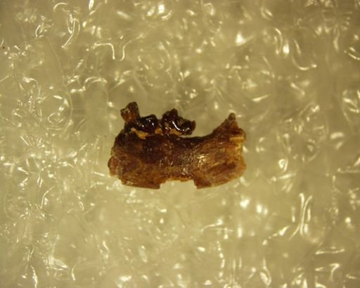 Adapisoricidae sp.