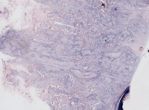 Leishmania tropica