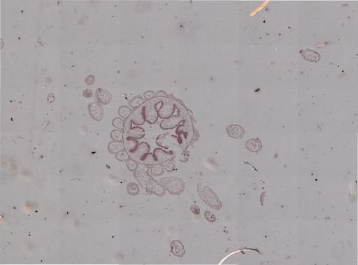 Tubularia