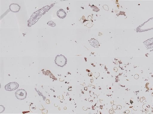 Distomum