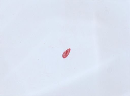 Paramecium aurelia