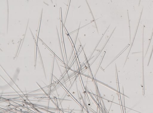 Stelletta anancora