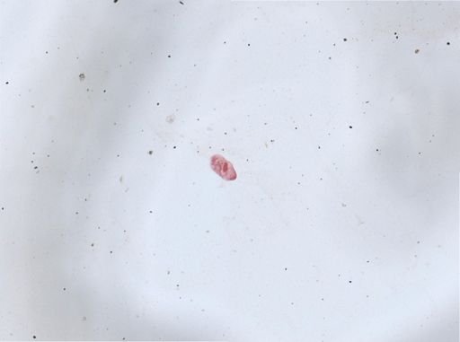 Paramecium aurelia