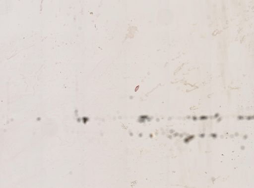 Paramecium