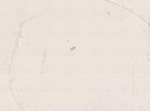 Paramecium bursaria
