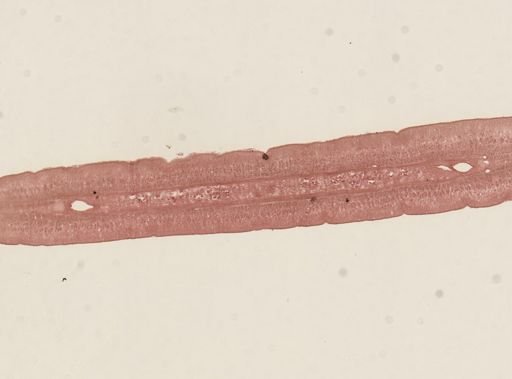 Taenia taeniaeformis