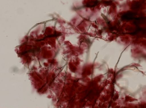 Isodictya deichmannae