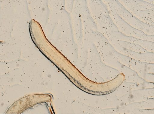 Oligochaeta