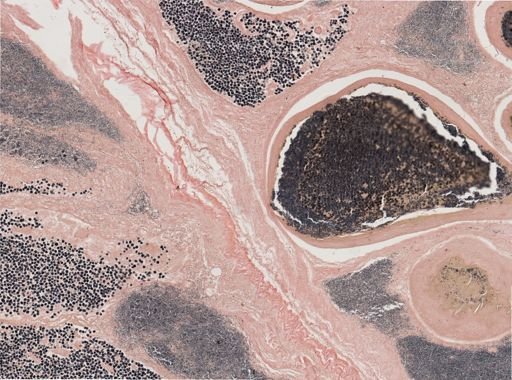 Ichthyosporidium