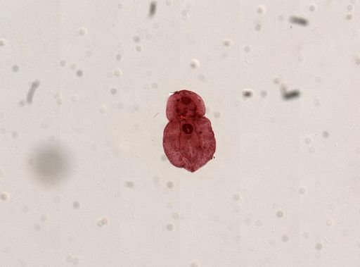 Posthodiplostomum minimum