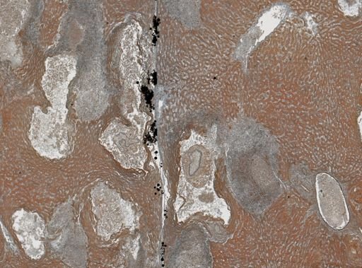 Taenia crassicollis