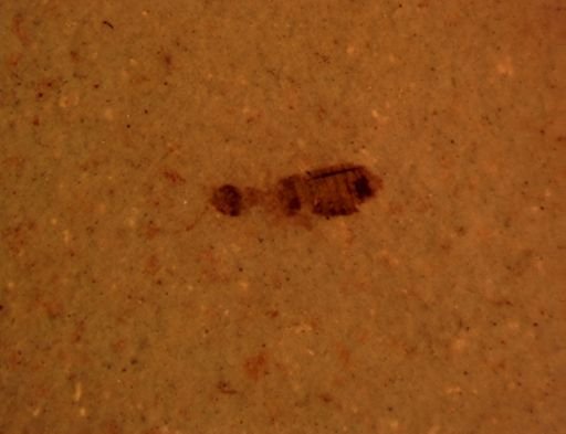 Staphylinidae?