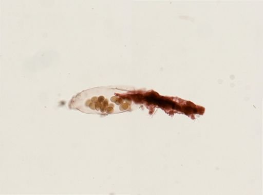 Dactylobiotus