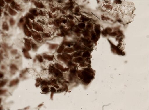 Alcyonidium