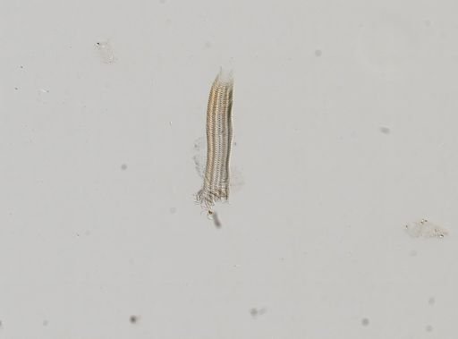 Somatogyrus integra