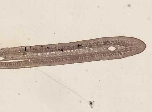 Taenia taeniaeformis