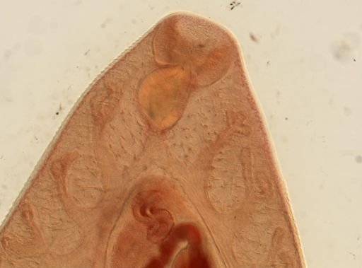 Fasciola hepatica