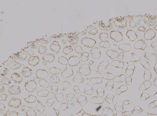 Acanthochaetetes wellsi