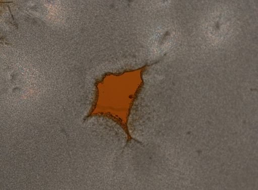 Lecane flexilis