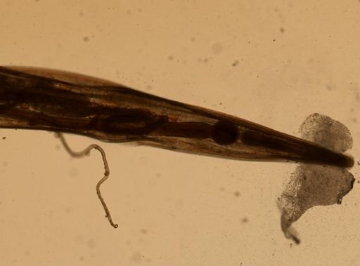 Enterobius vermicularis