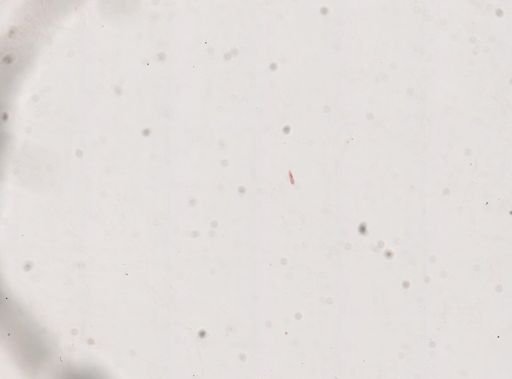 Paramecium