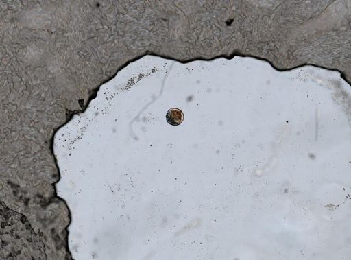 Testudinella patina